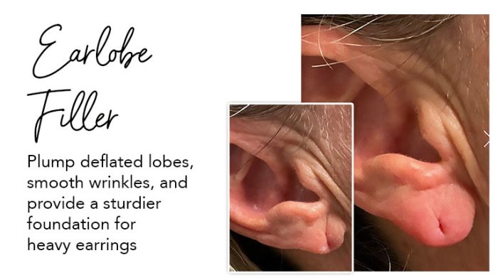 earlobe