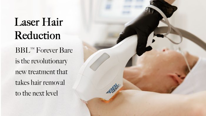 hairreduction carousel