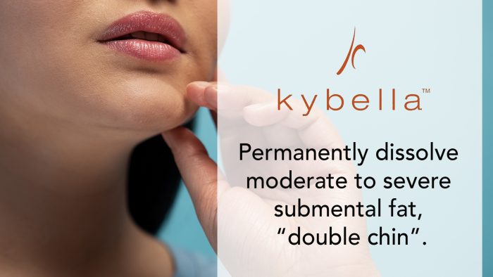 kybella